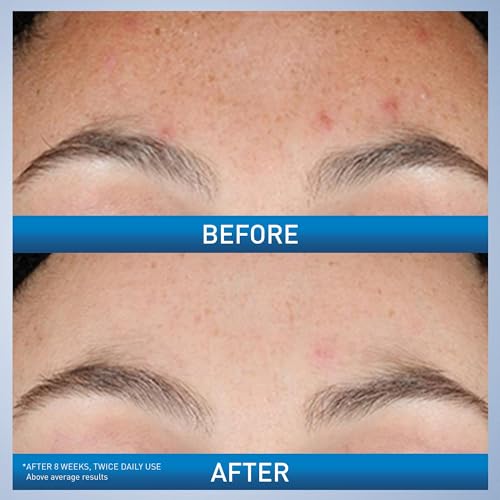 CeraVe Retinol Serum