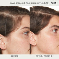 Thumbnail for OUAI Beauty 60 ml OUAI Scalp Serum - Balancing and Hydrating Serum