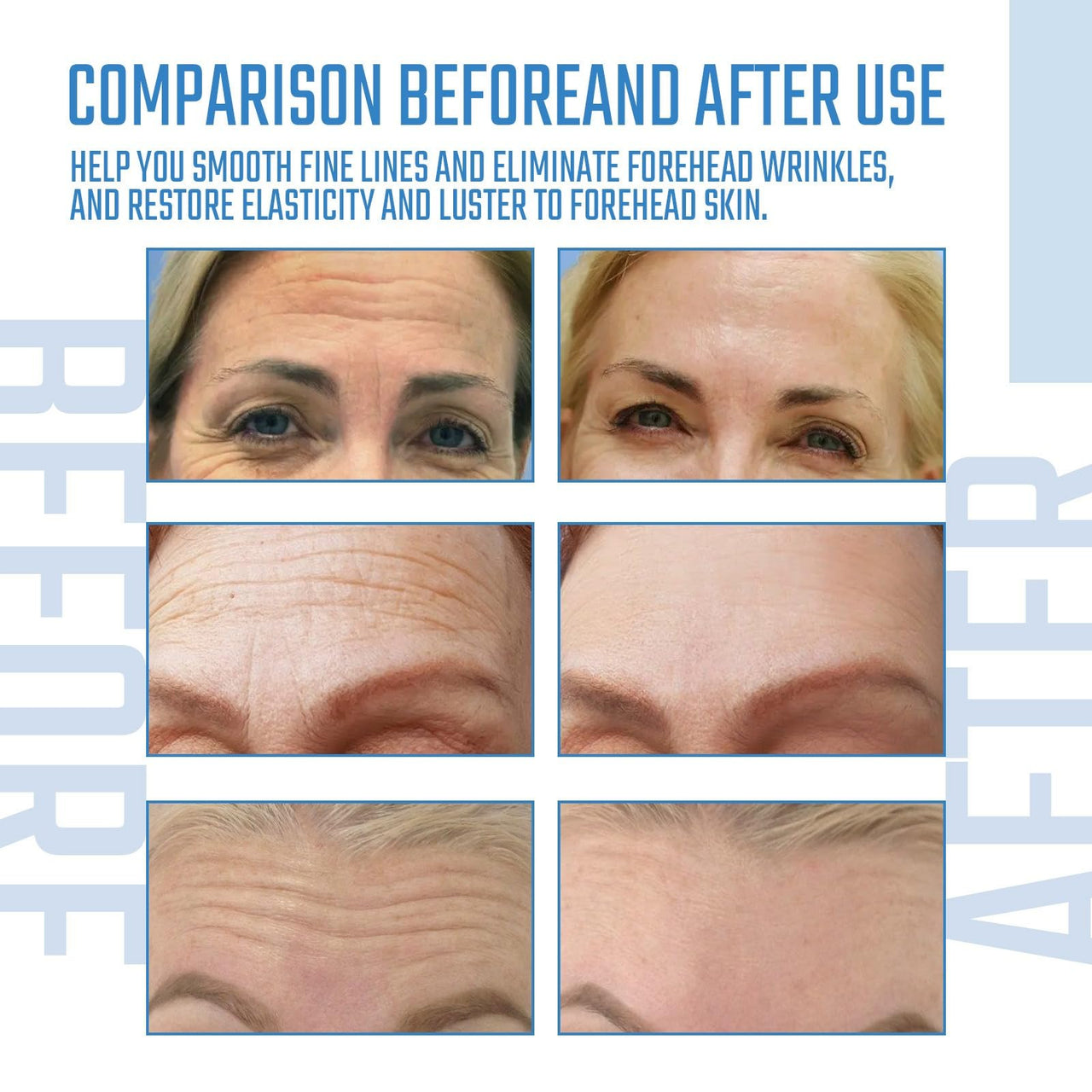 Before and after comparison of forehead skin with text indicating product effects.