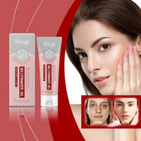 Thumbnail for Nicotinamide Face Gel—with Niacinamide, Glycerin, and Hyaluronic Acid