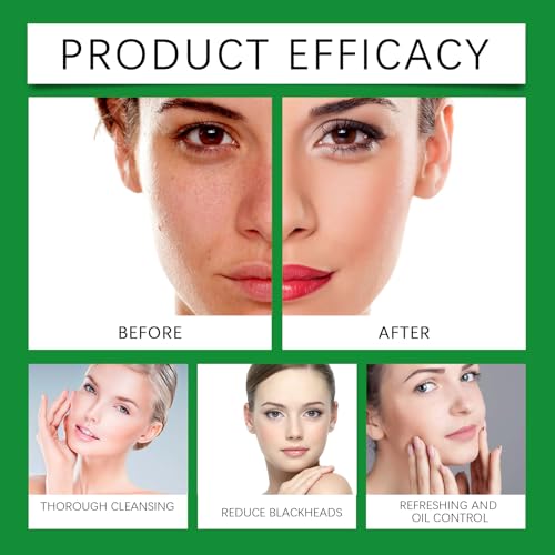 Aloe Vera Cleansing Foam with Sodium Hyaluronate - Hoygi