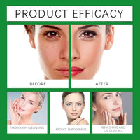 Thumbnail for Aloe Vera Cleansing Foam with Sodium Hyaluronate - Hoygi