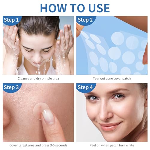 Daolyo Pimple Patches for Face