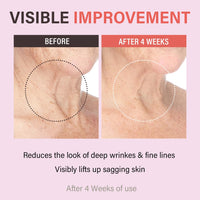 Thumbnail for Retinol Collagen Lifting Neck Cream,Anti Aging Face and Neck Cream for Reduce Wrinkles and Hydrating & Lifting Neck,For Face, Neck, Décolleté Wrinkle Care, 1.76 oz.