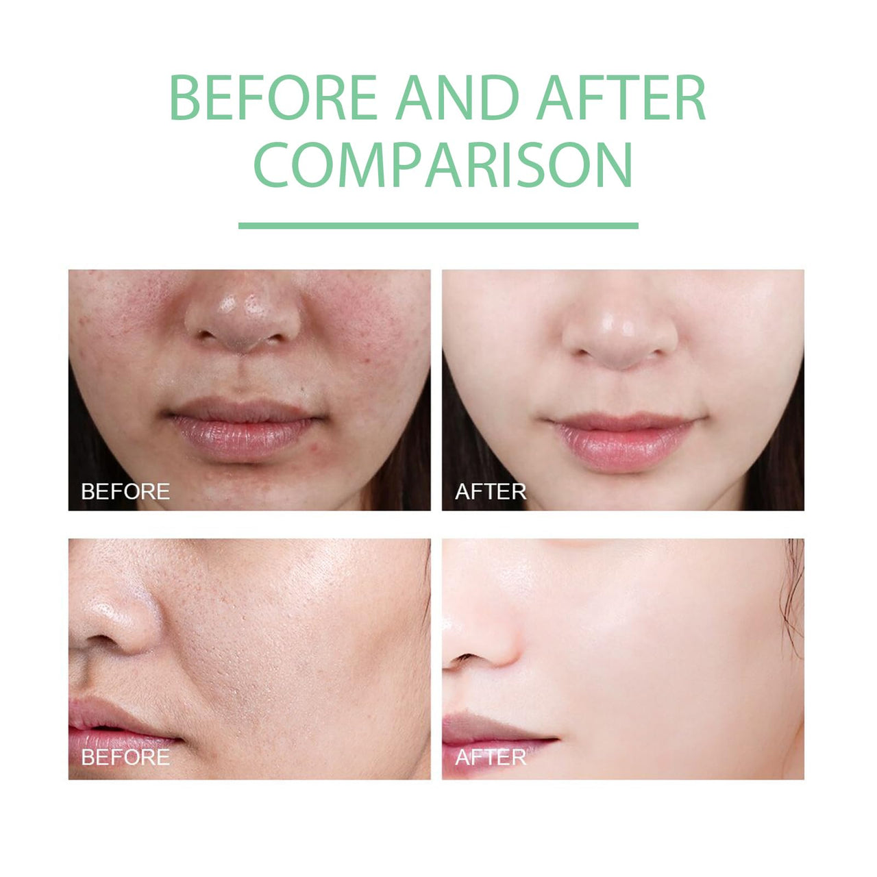 Deep Pore Cleanser- Exfoliating - Hoygi