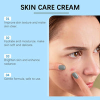 Thumbnail for 20% Azelaic Acid Acne Cream for Face, 20% Azelaic Acid Serum, Clear Tone Skin Cream, It Can Relieve Facial Redness, Balance Excess Oil, Soothe Skin Without Irritation - 0.26 OZ (1pc)