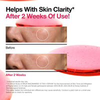 Thumbnail for Anua Niacinamide Dark Spot Prep & Boost Duo, Mini Sheet Face for Skin Clarity, Tranexamic acid,Hyaluronic Acid for glass skin, Glow radiance synergy, Day & Night Routine, Korean skincare set