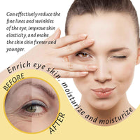 Thumbnail for Eye Roller for Puffy Eyes, Castor Oil and Frankincense Eye Roller for Dark Circles, and Wrinkles, Anti Aging Eye Serum Cream, Glass Bottle, 2 PCS