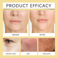 Thumbnail for BeeVenom Lift Cream