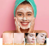 Thumbnail for Turmeric Brightening Facial Cleanser