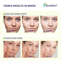 Thumbnail for Turmeric Kojic Acid Cleansing Pads