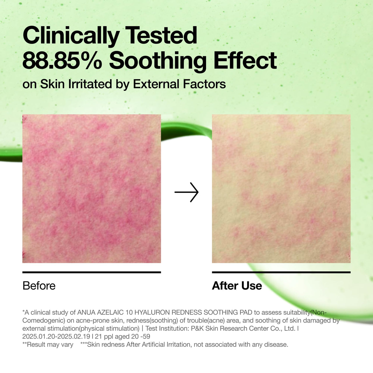 Anua Azelaic 10 Hyaluron Redness Soothing Pad, Troubled & Spot Care with Korean toner pads, Quick & Easy Stretchable Facial Mask with Azelaic acid, Hyaluronic Acid, Korean Skin Care (90 pads)