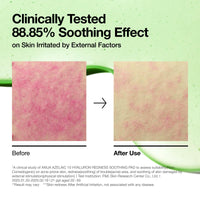 Thumbnail for Anua Azelaic 10 Hyaluron Redness Soothing Pad, Troubled & Spot Care with Korean toner pads, Quick & Easy Stretchable Facial Mask with Azelaic acid, Hyaluronic Acid, Korean Skin Care (90 pads)