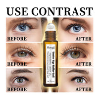 Thumbnail for Eye Roller for Puffy Eyes, Castor Oil and Frankincense Eye Roller for Dark Circles, and Wrinkles, Anti Aging Eye Serum Cream, Glass Bottle, 2 PCS