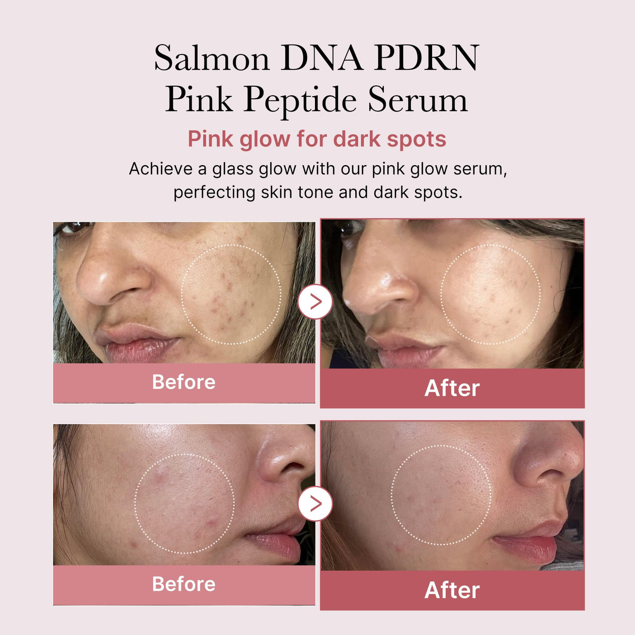 medicube Salmon DNA PDRN Duo for Beginner