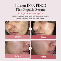 Thumbnail for medicube Salmon DNA PDRN Duo for Beginner
