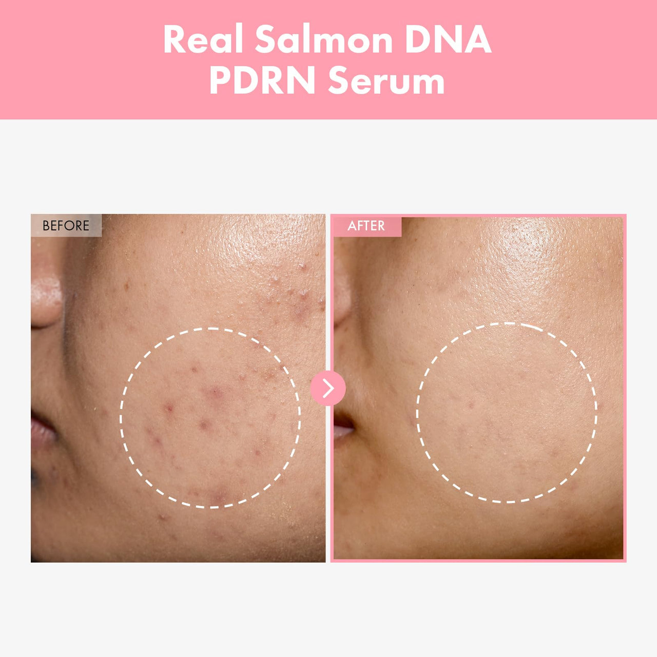 Pink Peptide 12 PDRN Serum