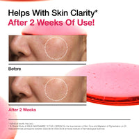 Thumbnail for Anua Ultimate Glow Protection Duo, Zero-Cast Moisturizing Finish Sunscreen + Niacinamide 10 + TXA 4 Serum, SPF 50,No White Cast, Facial Serum for face, Korean skincare Set