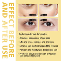 Thumbnail for Eye Roller for Puffy Eyes, Castor Oil and Frankincense Eye Roller for Dark Circles, and Wrinkles, Anti Aging Eye Serum Cream, Glass Bottle, 2 PCS