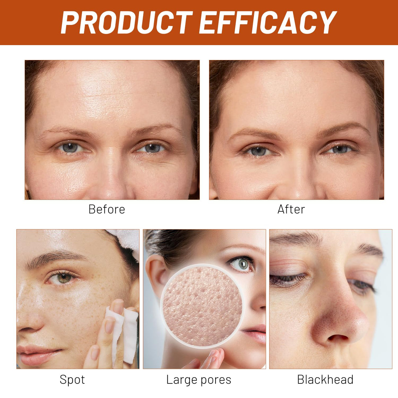 Parowu Herbal Spots Peel-Off Facial Mask