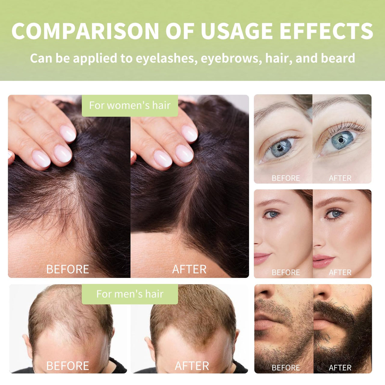 HOYGI Hair Growth Oil, 6-in-1 Serum with Cold Pressed Castor, Coconut, Rosemary, Argan Oils, Biotin, Caffeine for Hair, Eyelashes, Eyebrows and Beard, 2 Fl Oz/pcs