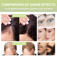Thumbnail for HOYGI Hair Growth Oil, 6-in-1 Serum with Cold Pressed Castor, Coconut, Rosemary, Argan Oils, Biotin, Caffeine for Hair, Eyelashes, Eyebrows and Beard, 2 Fl Oz/pcs