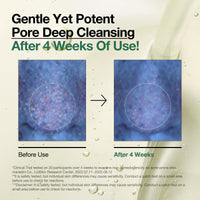 Thumbnail for Auna Deep Pore Treatment Duo Heartleaf Pore Control Cleansing Oil, Heartleaf 77 Toner Pad, Exfoliating Facial Pads, After-Cleansing for Gentle Facial Care, Korean Skincare set