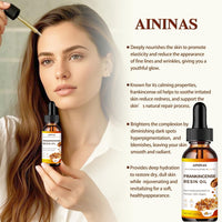 Thumbnail for AININAS Organic Frankincense Resin Facial Oil