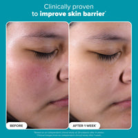 Thumbnail for Paula's Choice SKIN PERFECTING 2% BHA Liquid Salicylic Acid Exfoliant-Facial Exfoliant for Enlarged Pores, Wrinkles & Fine Lines, Suitable for Blackhead-Prone Skin, Fragrance-Free