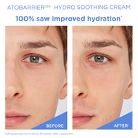 Thumbnail for AESTURA ATOBARRIER365 Hydro Essence + Hydro Soothing Cream