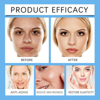 Thumbnail for Before and after effects of a skincare product on a woman's face, with text indicating product efficacy for anti-aging, reducing skin redness, and restoring elasticity.