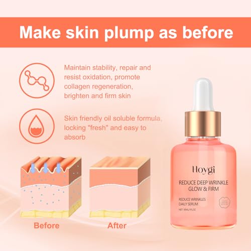 Hoygi skincare serum bottle with skin layer illustration and text on a pink background