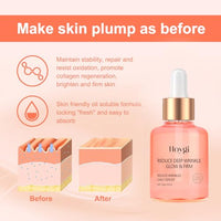 Thumbnail for Hoygi skincare serum bottle with skin layer illustration and text on a pink background