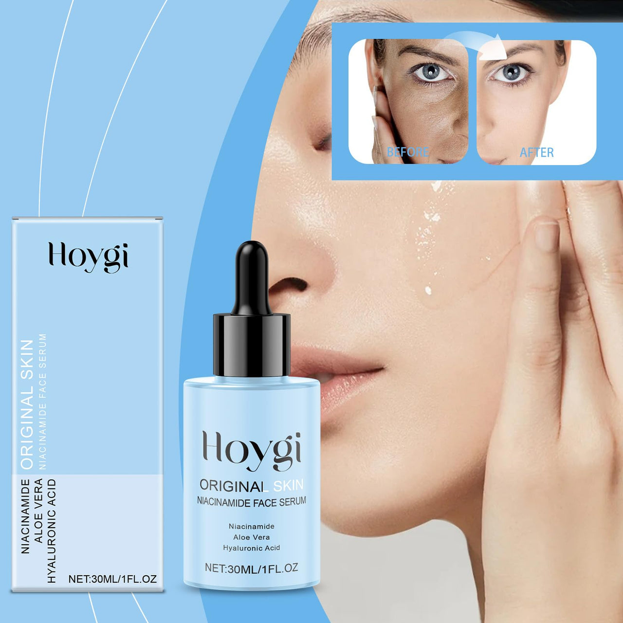Hoygi Original Skin Niacinamide Face Serum with packaging and before-and-after effect on skin.