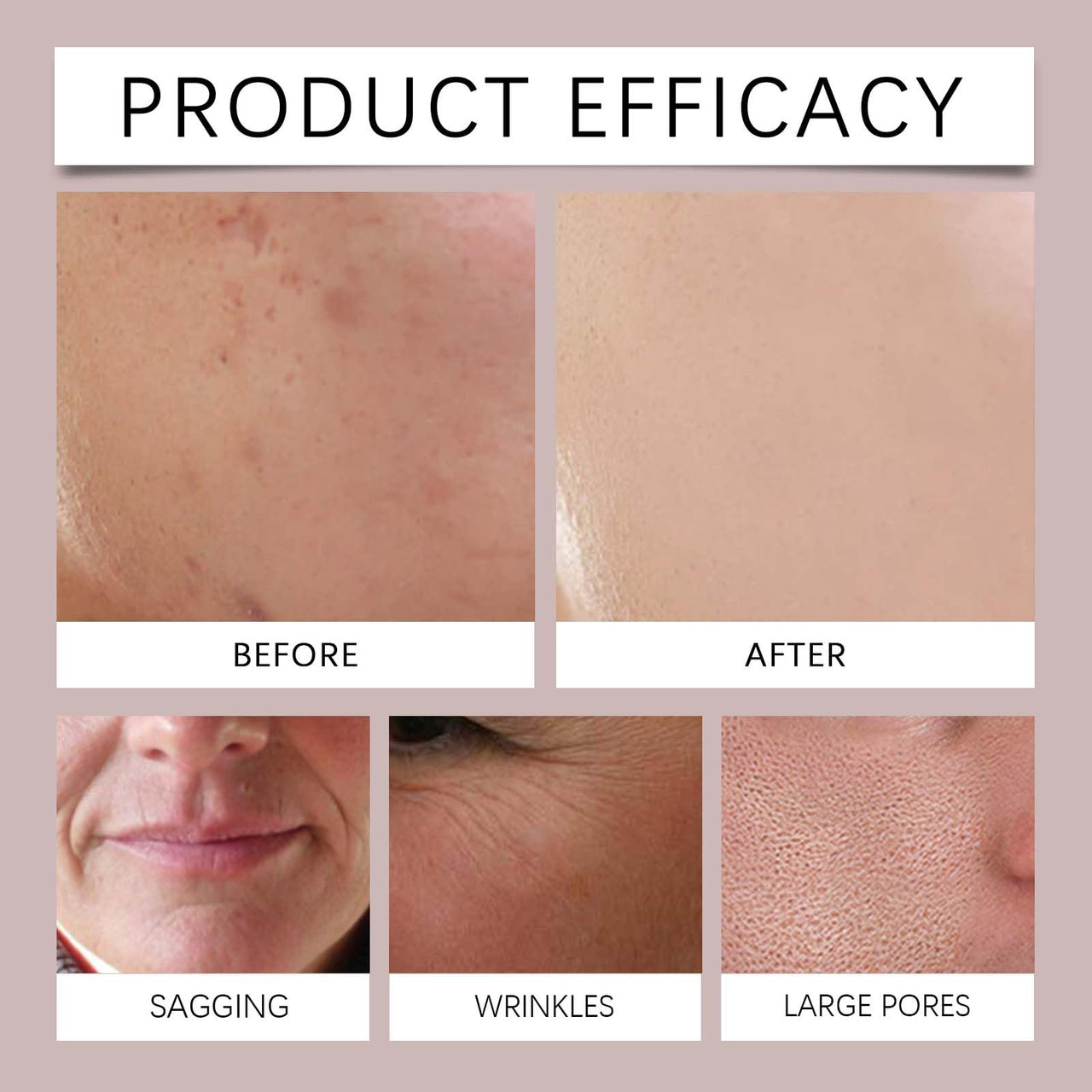 Before and after comparison of skin treatment product efficacy on various skin issues.