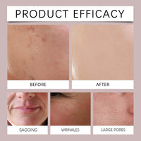 Thumbnail for Before and after comparison of skin treatment product efficacy on various skin issues.