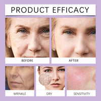 Thumbnail for Before and after comparison of a skincare product's effectiveness on different skin concerns.